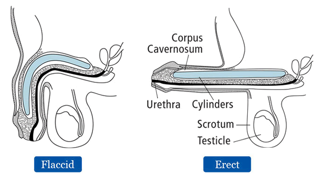 Diagram of Coloplast Genesis Penile Implant