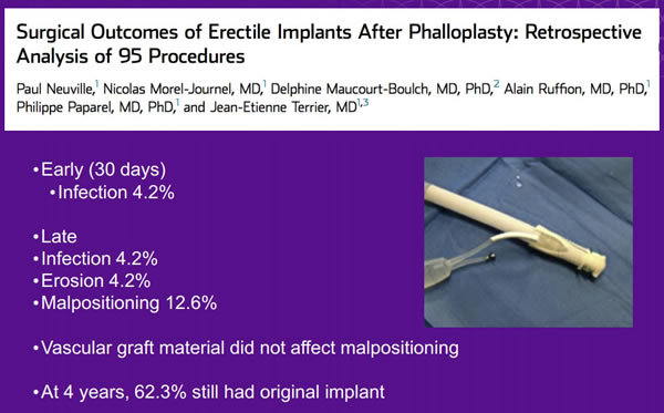 Surgical Outcomes of Erectile Implants After Phalloplasty